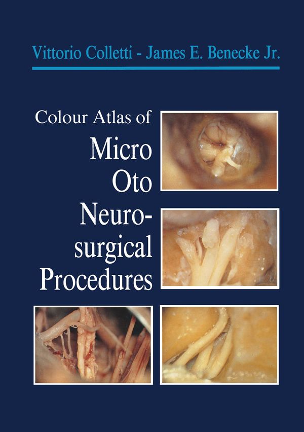 Colour Atlas of Micro-Oto-Neurosurgical Procedures | 1:a upplagan