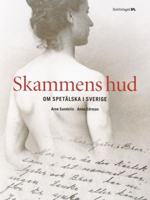 Skammens hud : om spetälska i Sverige | 1:a upplagan