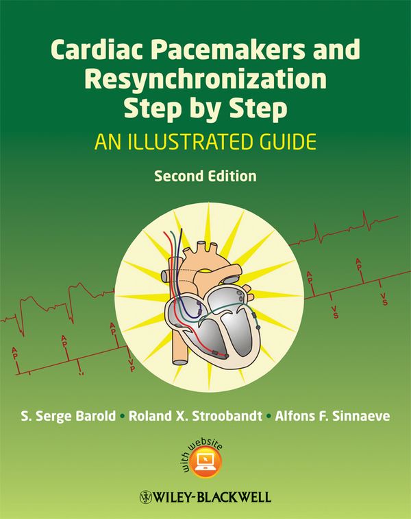 Cardiac Pacemakers and Resynchronization Step by Step: An Illustrated ...