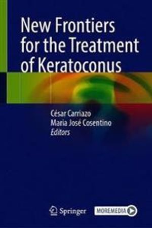 New Frontiers for the Treatment of Keratoconus | 1:a upplagan