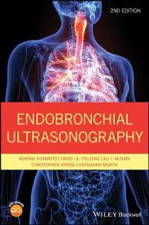 Endobronchial Ultrasonography |  2:e upplagan