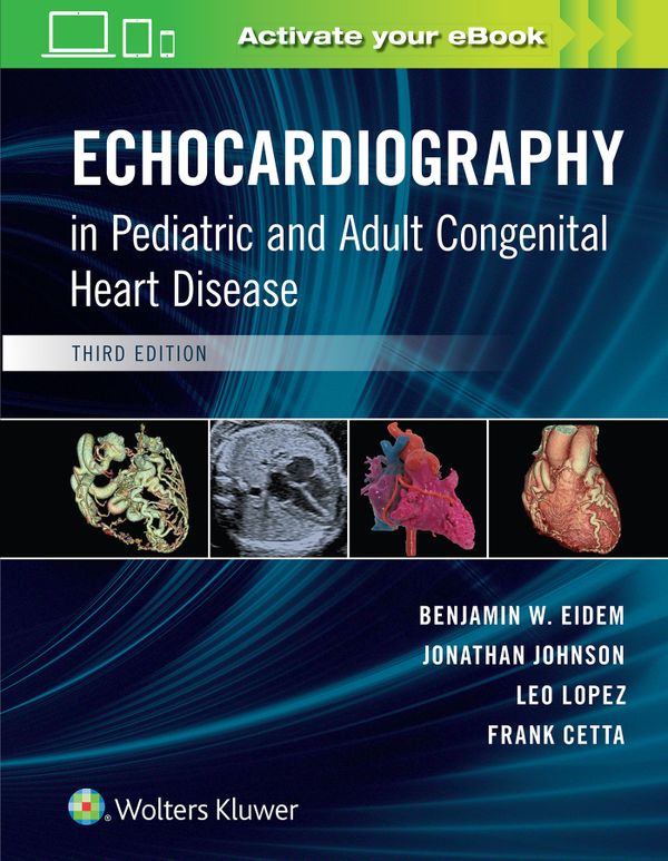 Echocardiography in Pediatric and Adult Congenital Heart Disease | 0:e upplagan