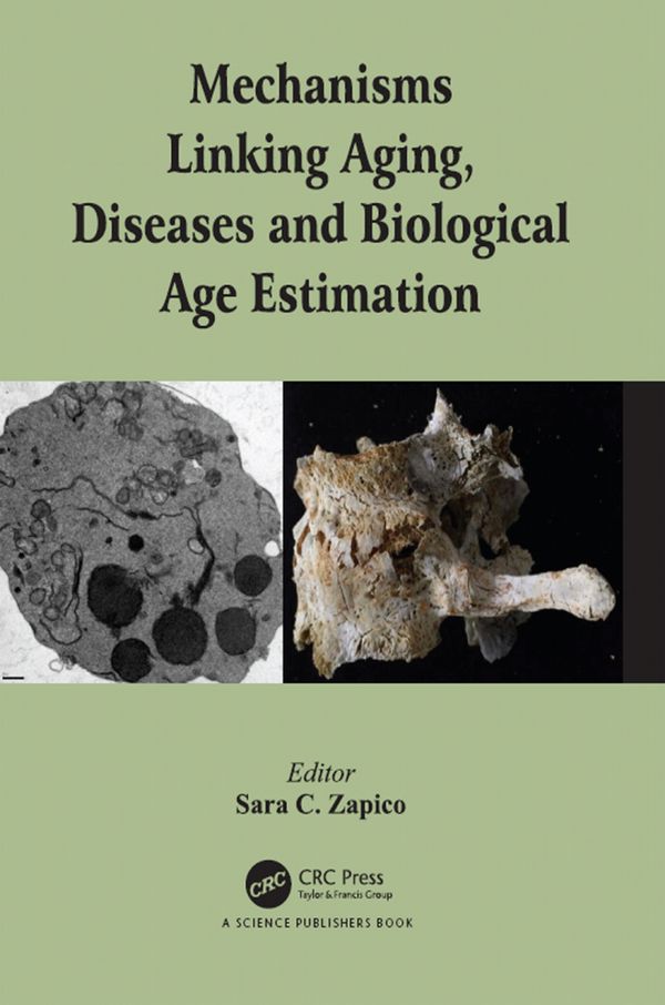Mechanisms Linking Aging, Diseases and Biological Age Estimation | 1:a upplagan