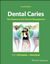 Dental Caries