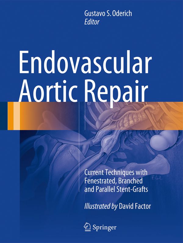 Endovascular Aortic Repair | 1:a upplagan
