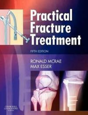 Practical fracture treatment | 5:e upplagan