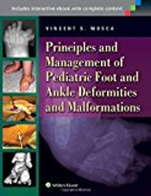 Principles and Management of Pediatric Foot and Ankle Deformities and Malformations