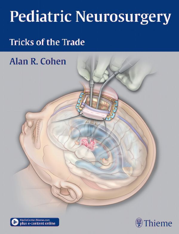 Pediatric Neurosurgery: Tricks of the Trade | 0:e upplagan