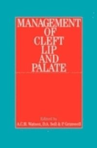 Management of Cleft Lip and Palate