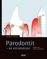 Parodontit, en introduktion