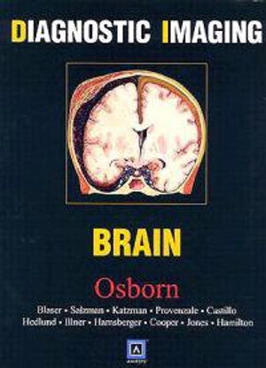 Diagnostic Imaging: Brain