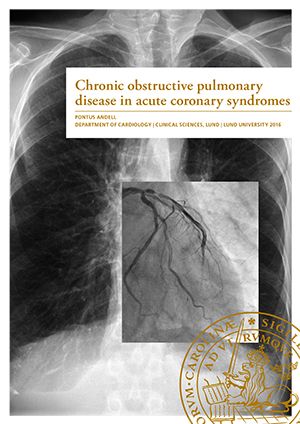Chronic obstructive pulmonary disease in acute coronary syndroms | 0:e upplagan