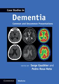 Case Studies in Dementia: Volume 1 | 0:e upplagan