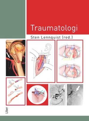 Traumatologi |  2:e upplagan