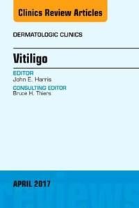 Vitiligo, an issue of dermatologic clinics | 0:e upplagan