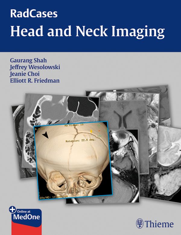 RadCases Head and Neck Imaging | 0:e upplagan