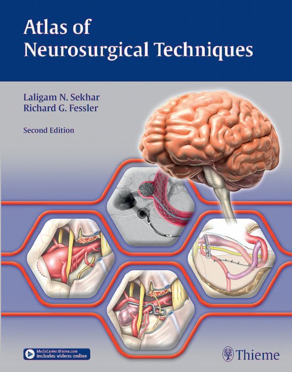 Atlas of Neurosurgical Techniques | 2:a upplagan