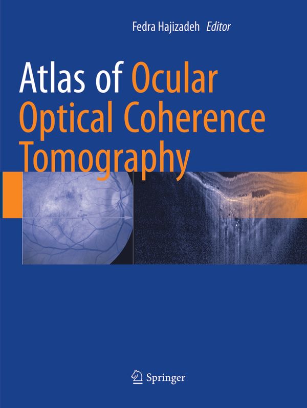 Atlas of Ocular Optical Coherence Tomography | 1:a upplagan