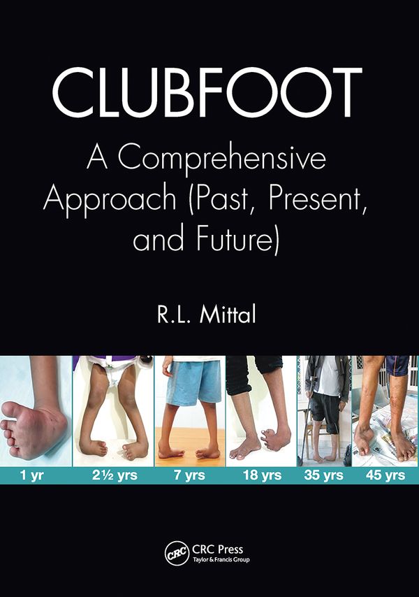 Clubfoot | 1:a upplagan