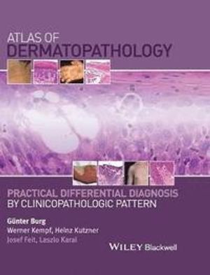 Atlas of Dermatopathology: Practical Differential Diagnosis by Clinicopatho | 1:a upplagan