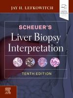 Scheuer's Liver Biopsy Interpretation | 10:e upplagan
