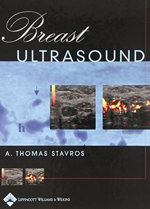 Breast ultrasound