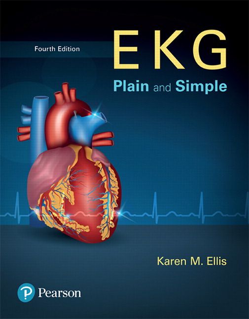 EKG Plain and Simple | 4:e upplagan