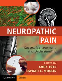 Neuropathic Pain | 0:e upplagan