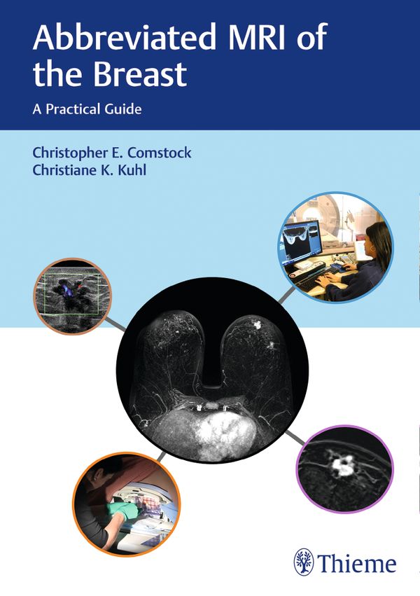 Abbreviated MRI of the Breast | 0:e upplagan