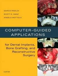 Computer-Guided Applications for Dental Implants, Bone Grafting, and Reconstructive Surgery (adapted translation) | 0:e upplagan