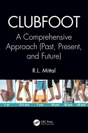 Clubfoot | 1:a upplagan