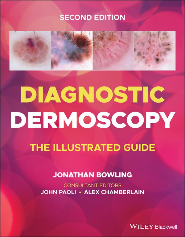 Diagnostic Dermoscopy | 2:a upplagan