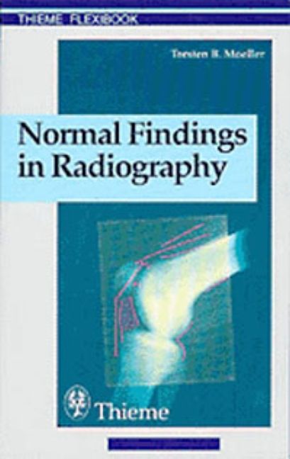 Normal Findings in Radiography | 0:e upplagan