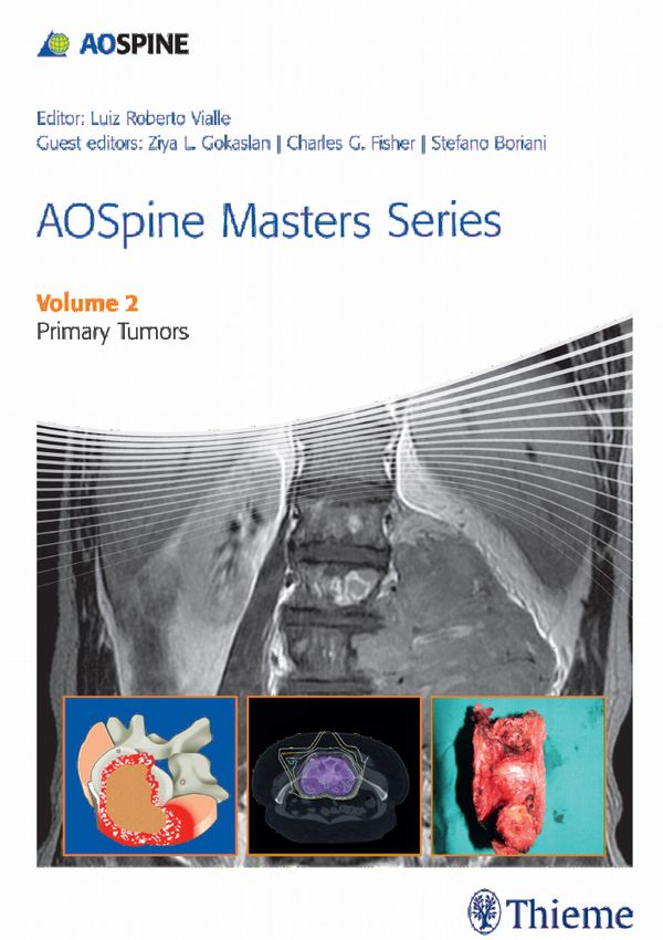 AOSpine Masters Series Volume 2: Primary Spinal Tumors | 0:e upplagan