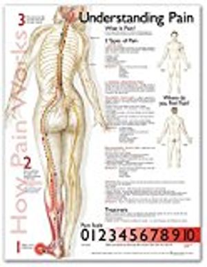 Understanding Pain Anatomical Chart