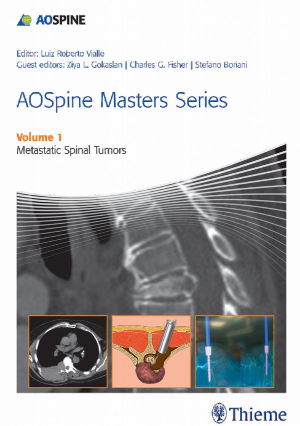 AOSpine Masters Series Volume 1: Metastatic Spinal Tumors | 0:e upplagan