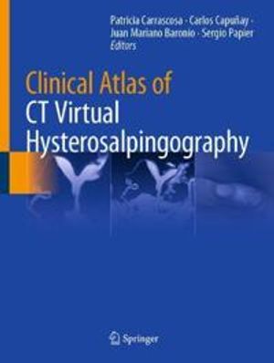 Clinical Atlas of CT Virtual Hysterosalpingography | 1:a upplagan