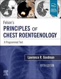 Felson's Principles of Chest Roentgenology, A Programmed Text | 5:e upplagan
