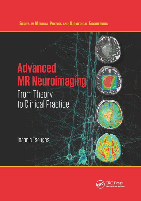 Advanced MR Neuroimaging | 1:a upplagan