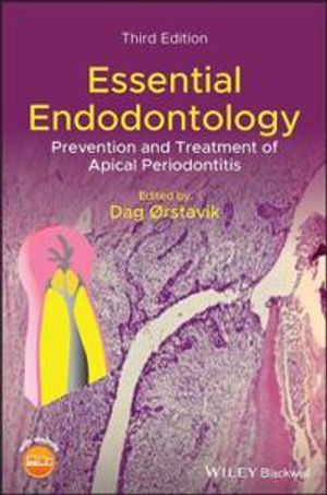 Essential Endodontology | 3:e upplagan