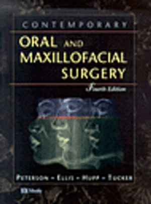 Contemporary Oral and Maxillofacial Surgery