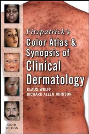 Fitzpatrick's Color Atlas and Synopsis of Clinical Dermatology: Sixth Edition | 6:e upplagan