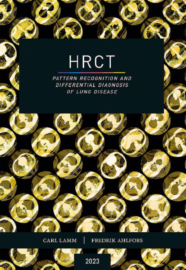 HRCT – Pattern Recognition and Differential Diagnosis of Lung Disease | 5:e upplagan