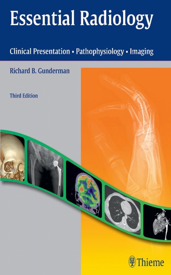 Essential Radiology | 3:e upplagan