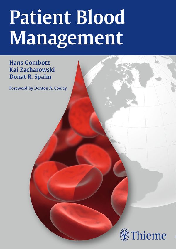 Patient Blood Management | 0:e upplagan