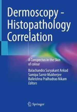 Dermoscopy - Histopathology Correlation | 1:a upplagan