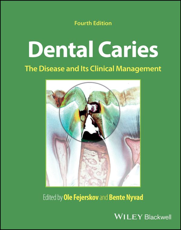 Dental Caries | 4:e upplagan