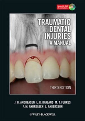 Traumatic Dental Injuries: A Manual [With DVD ROM] | 1:a upplagan