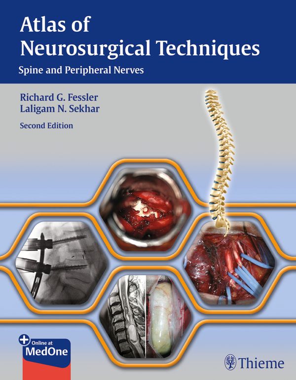 Atlas of Neurosurgical Techniques | 2:a upplagan