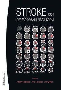 Stroke - och cerebrovaskulär sjukdom | 2:a upplagan